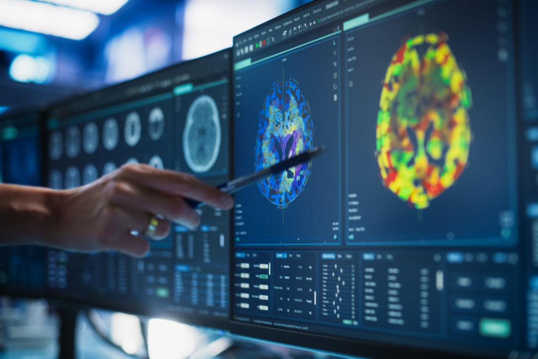 Illustration for news: Scientists Examine Neurobiology of Pragmatic Reasoning