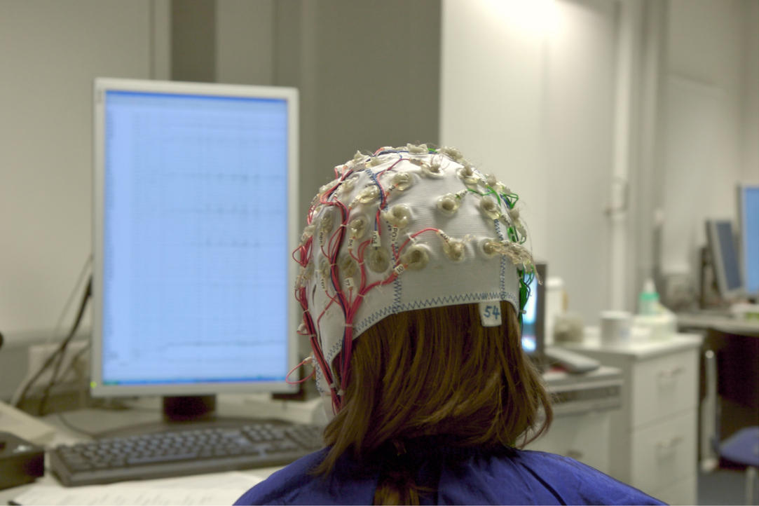 Illustration for news: Electrical Brain Stimulation Helps Memorise New Words