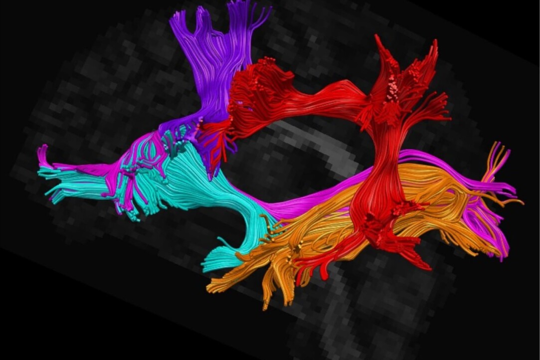 HSE Scientists Explain How to Identify Brain Areas Critical for Language Function During Surgery Illustration for news: HSE Scientists Explain How to Identify Brain Areas Critical for Language Function During Surgery